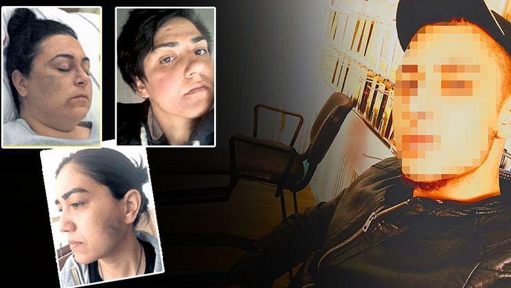 Turkish man released after saying he assaulted ‘wrong women’ in street