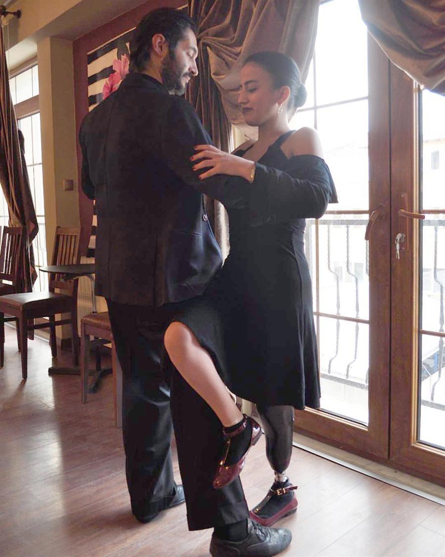 Amputee woman defies odds to become dancer