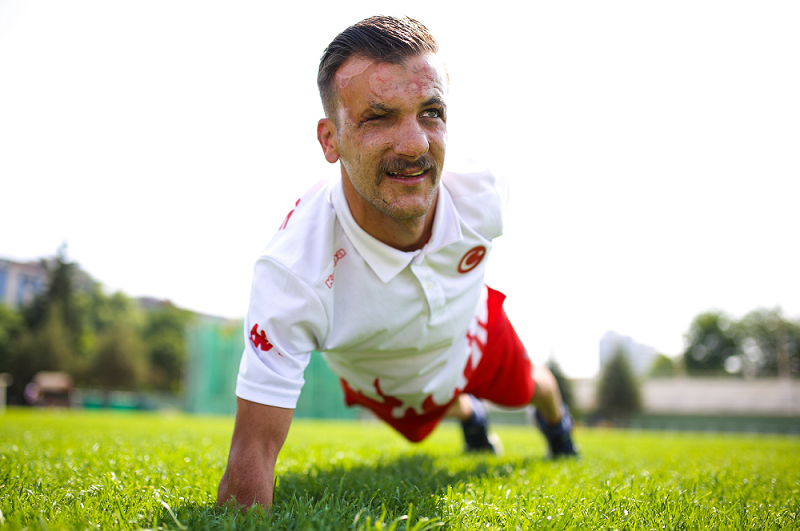 Landmine survivor doesn’t let losses hold him back
