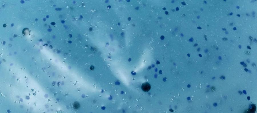 Microplastics in drinking water not a health risk for now: WHO