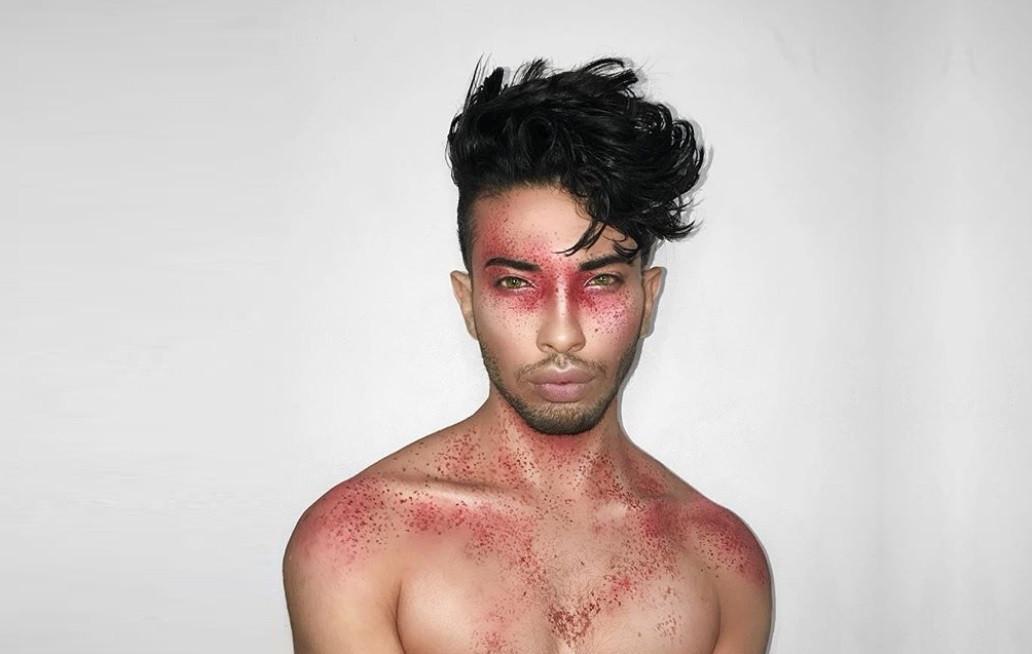 Gaza painter uses art to depict rare medical disorders