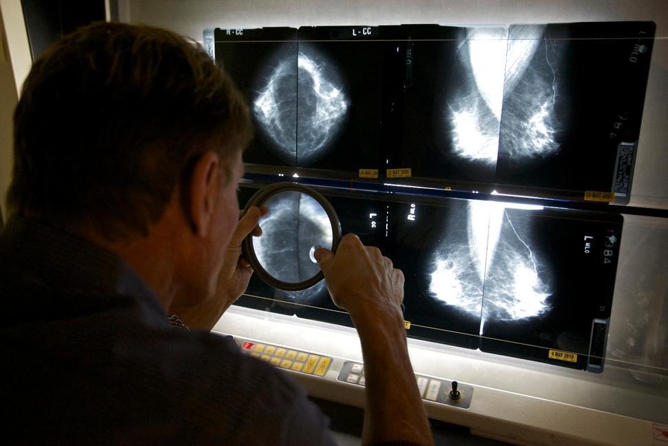 WHO forecasts 81 pct cancer jump in poorer countries