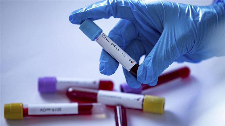Turkey ramps up virus measures as confirmed cases reach 47