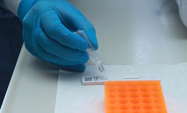 Turkey promotes quick kits for virus
