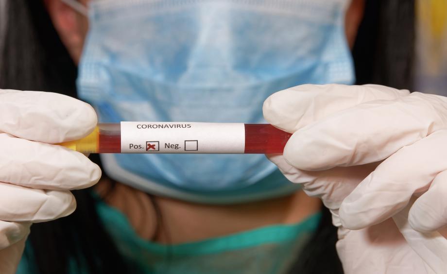 Coronavirus death toll up by 16 to 75, with 1,196 new cases
