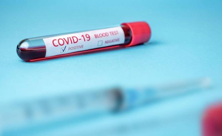 Ankara rebuffs claims of inaccurate coronavirus data as cases top 9,000