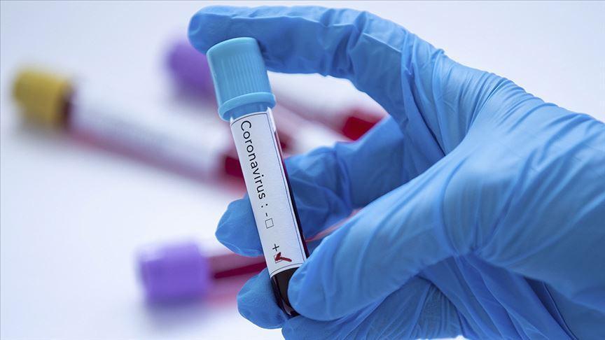 Turkey’s coronavirus death toll rises to 277, with 15,679 total cases