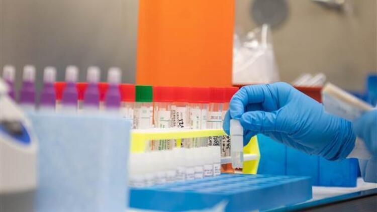 80 Turkish Cypriots die in UK due to coronavirus