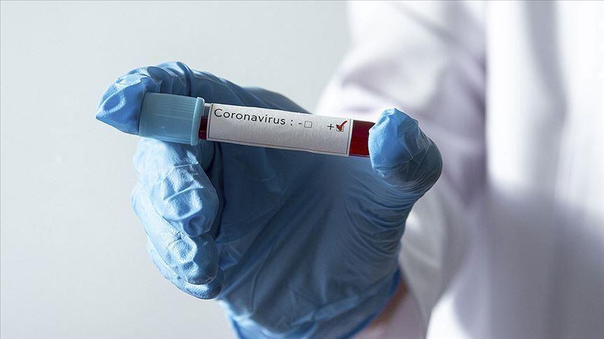 Pandemic far from over, cases underreported: WHO