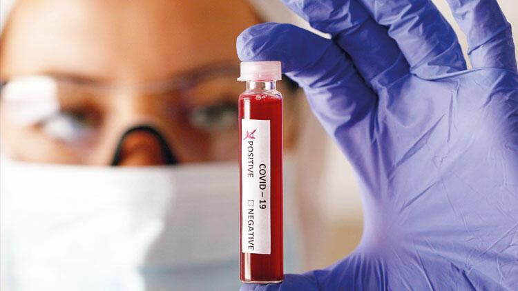 Our three weeks with the COVID-19 virus: Op-ed