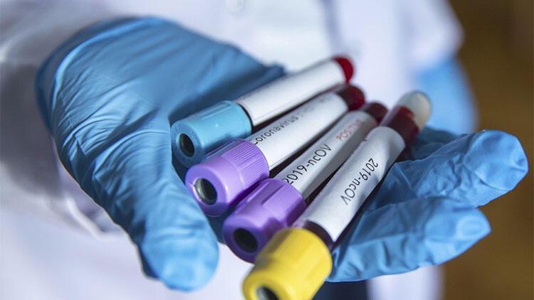 Nearly $300 mln raised for Turkey’s COVID-19 fight