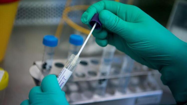 Turkey sets out new criteria for COVID-19 tests