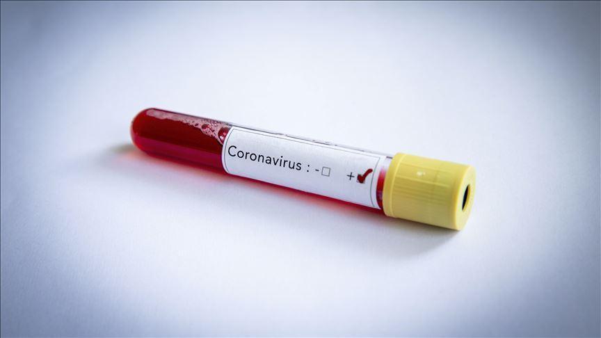 Ruling AKP lawmaker tests positive for coronavirus