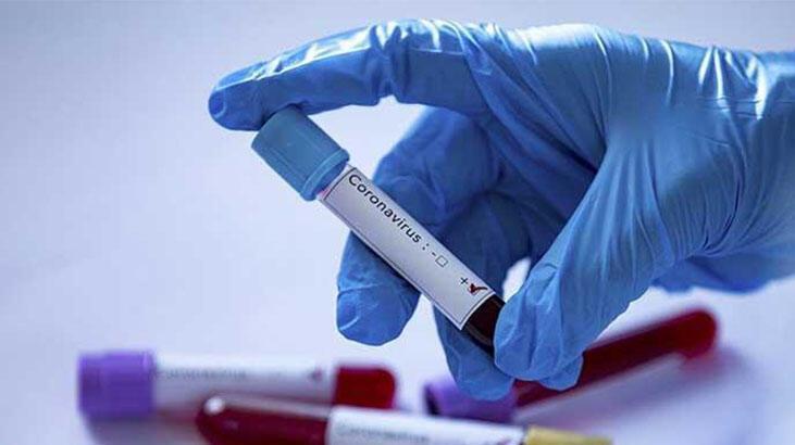 Severe virus cases continue to rise, warns Turkey’s health minister