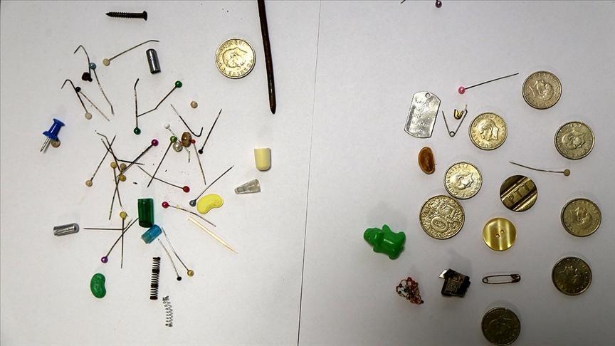 Turkish doctor reveals bizarre collection of accidentally swallowed items by people