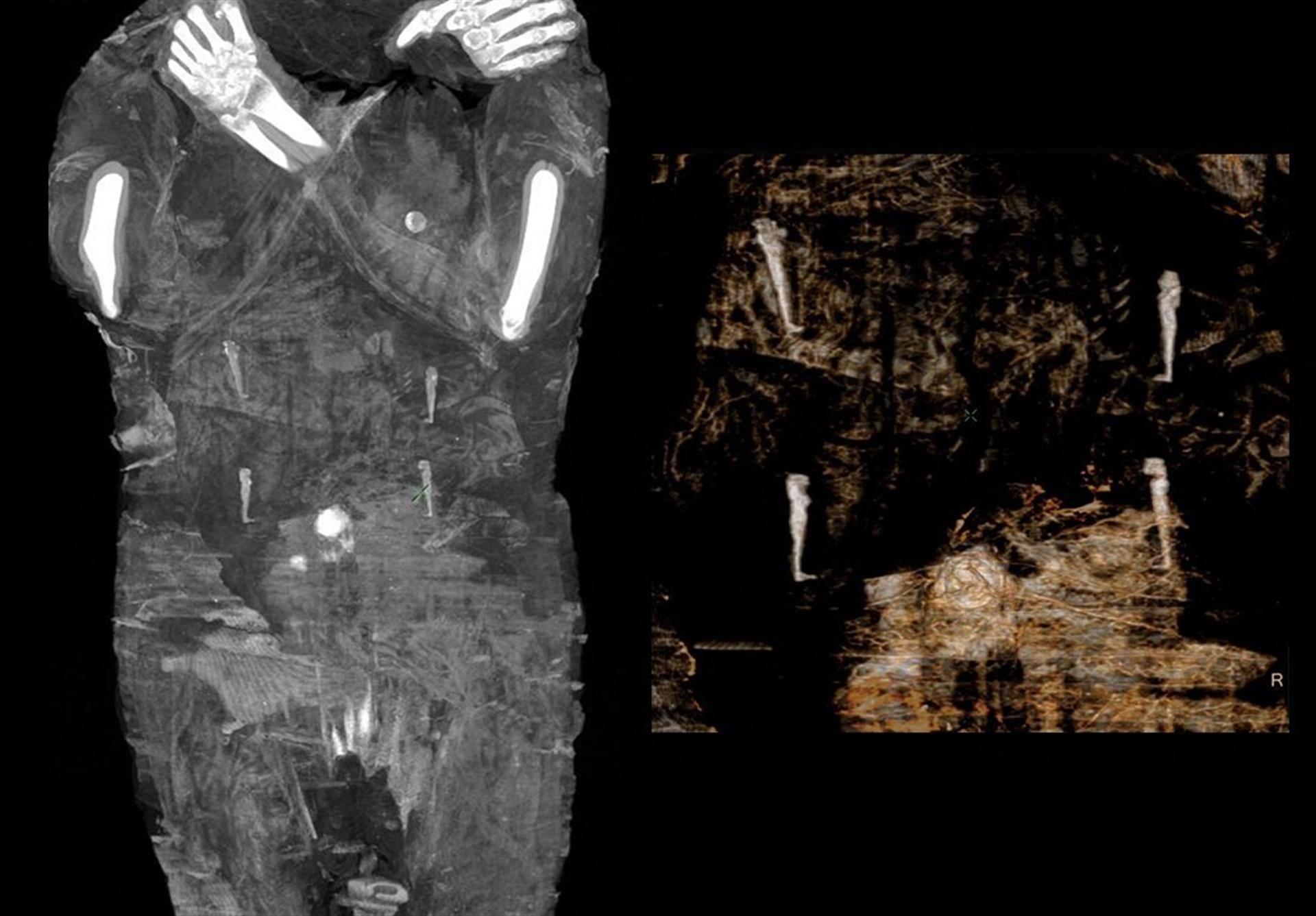 Egyptian mummy was a pregnant woman, not a male priest