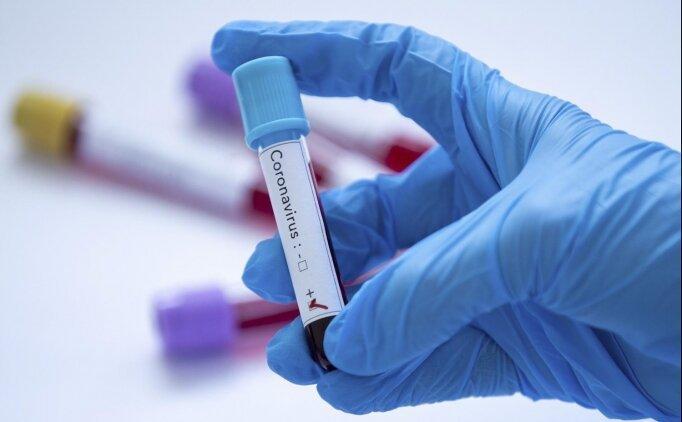 Two years since first COVID case reported in Turkey