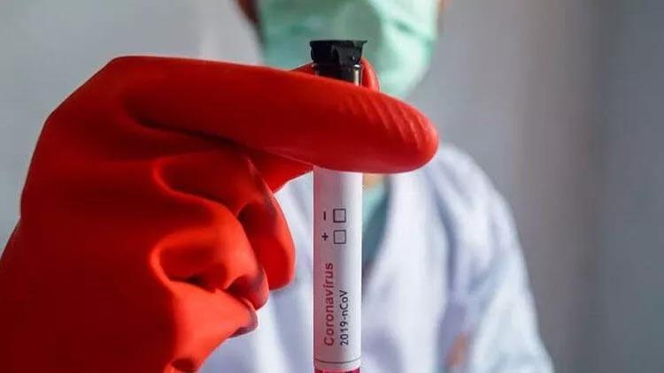 Pandemic less effective than before but not over, expert warns