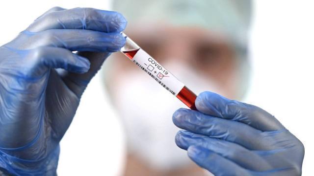 Weekly virus cases down in big cities
