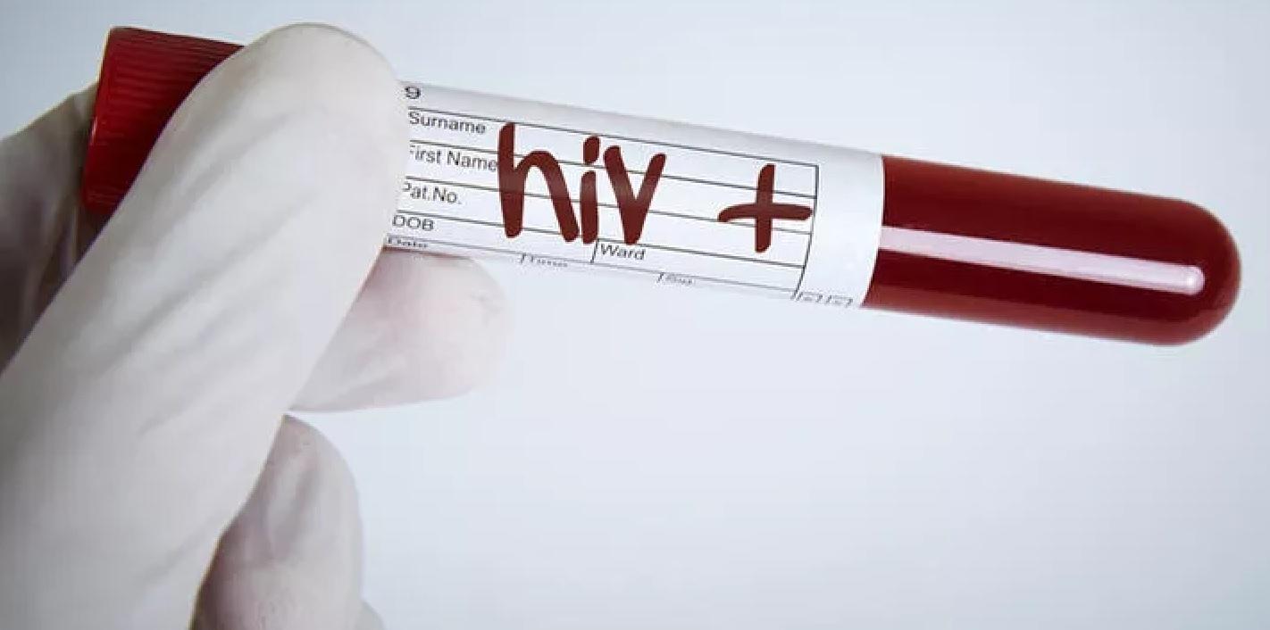 Aesthetician asks compensation for wrong HIV positive tests