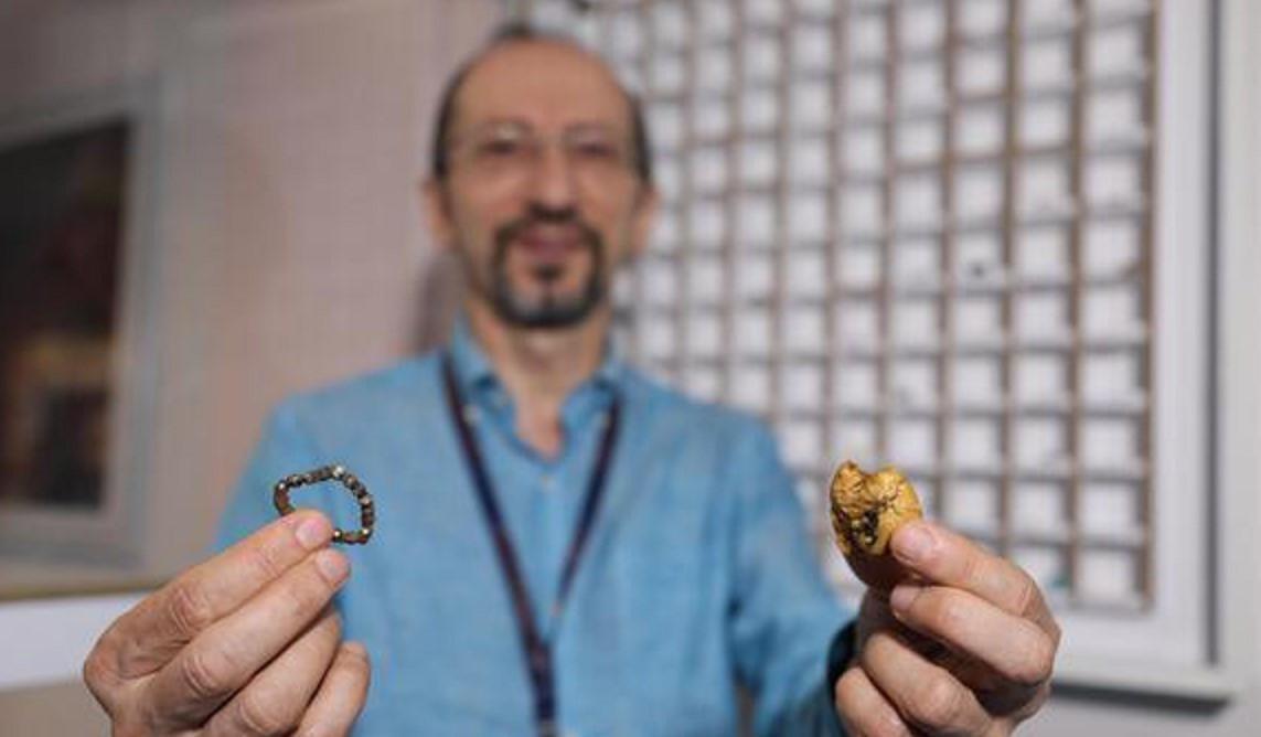 Objects swallowed by children on display at Antalya hospital