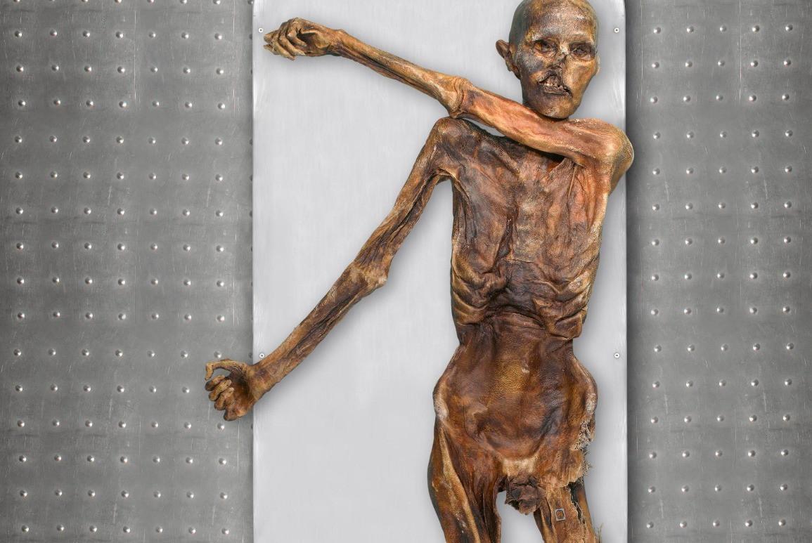 Oetzi the Iceman traces his roots to present day Türkiye