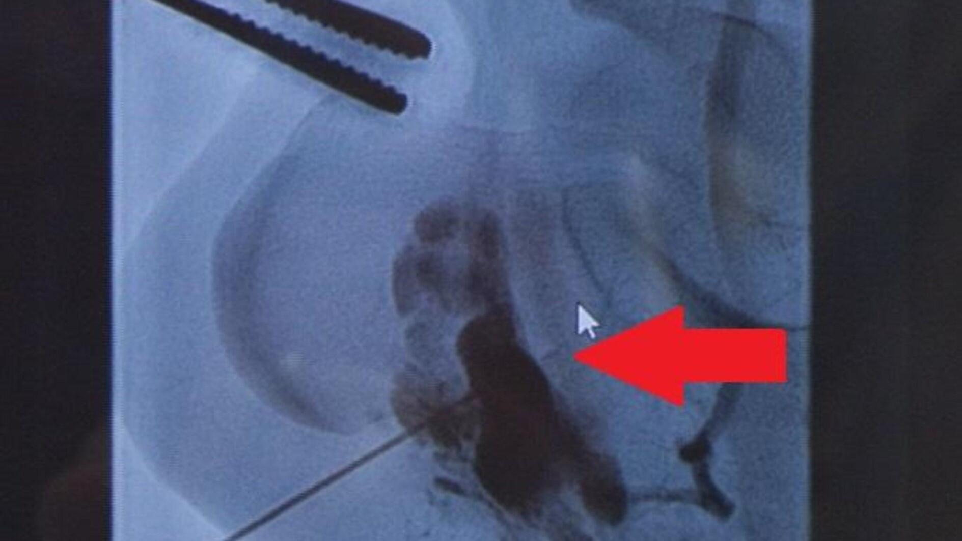 Surgeon of century saves ‘unrecoverable’ leg