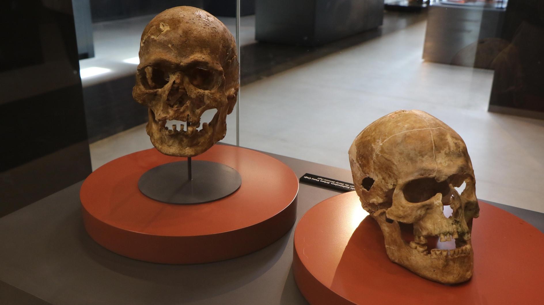 Scars on 5,000-year-old skull showcase ancient technique in Samsun Museum