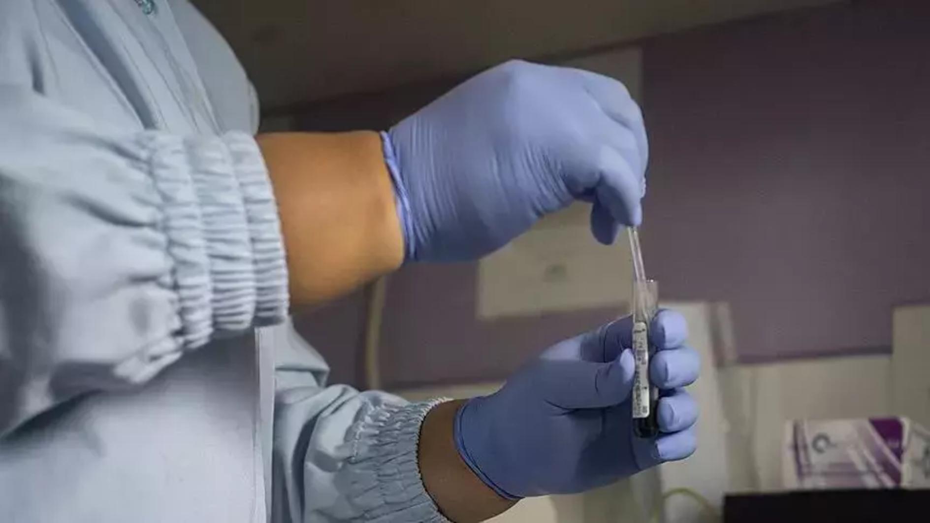 UN says 2024 decisive to ending AIDS as health threat