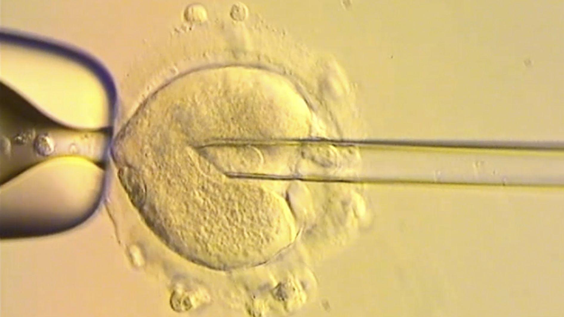 IVF trial reduces risk of babies inheriting diseases