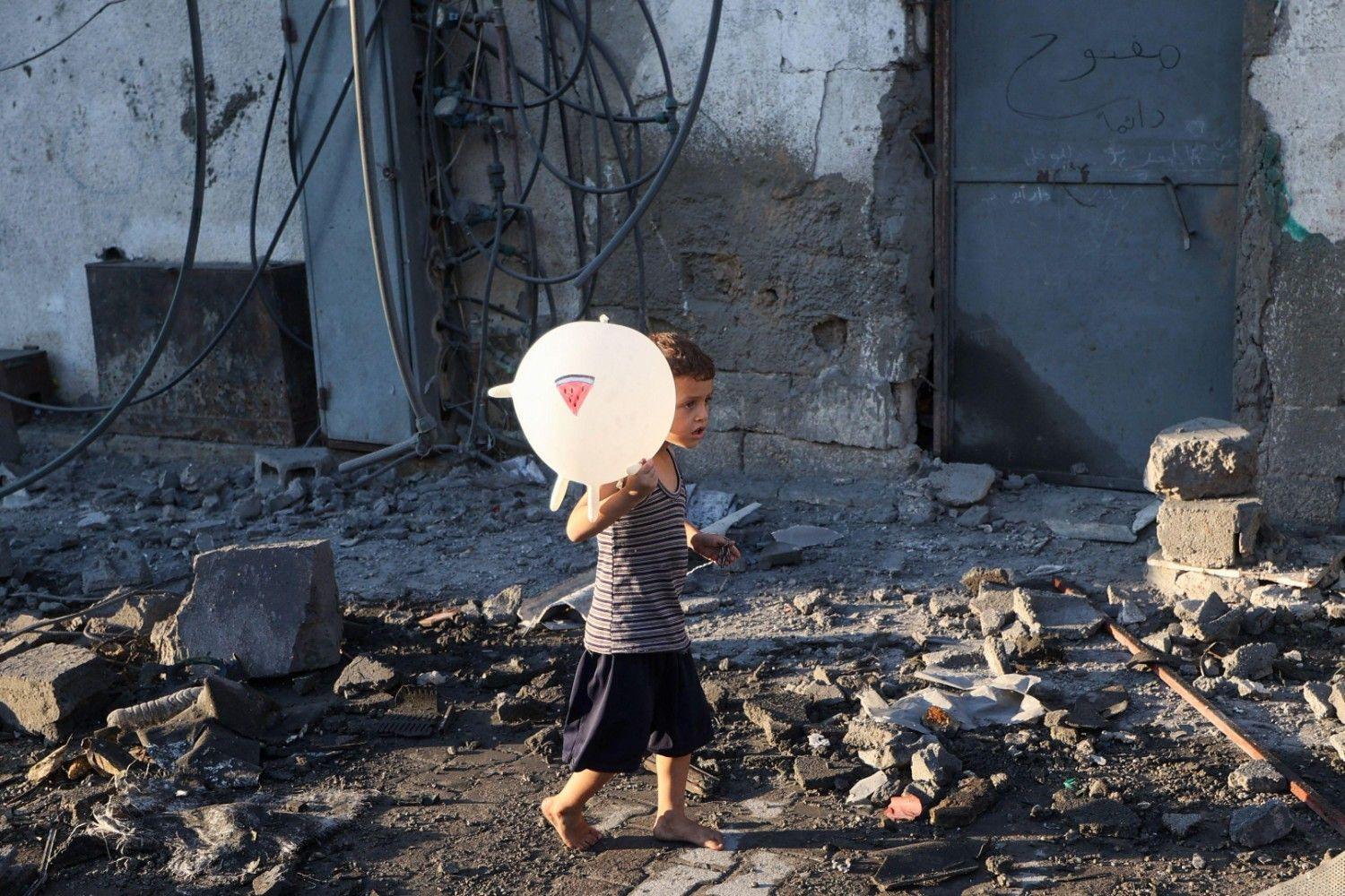 Int’l media sounds alarm as starvation grips Gaza