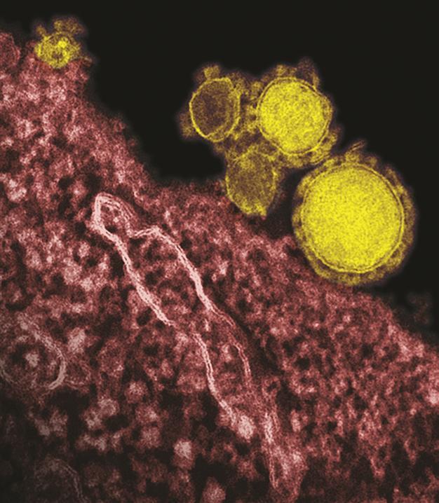 MERS coronavirus not yet pandemic