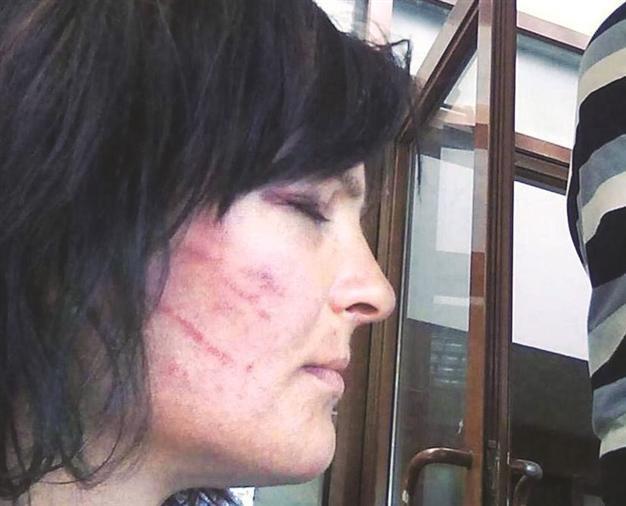 Doctor fined over inaccurate report on tortured woman in Turkeys west