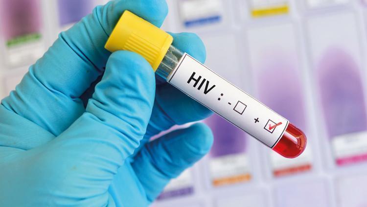 İngiltere de HIV skandalı