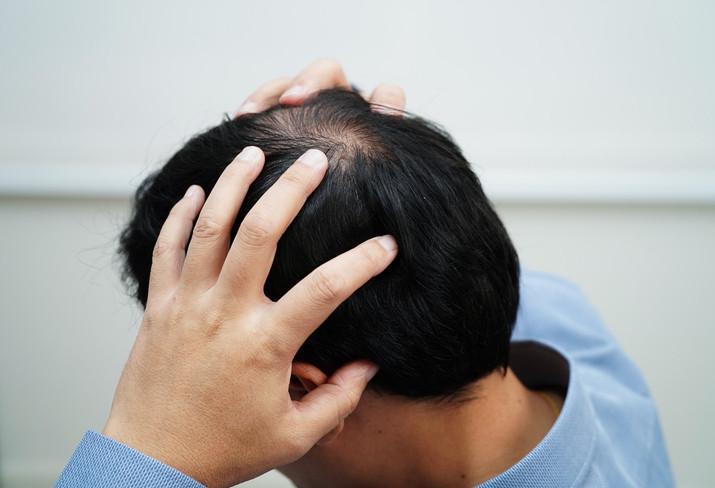 Kellik tarih mi oluyor?