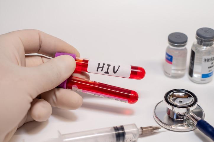 1 Aralık dünya ne günü? 1 Aralık Dünya AIDS Günü nedir? AIDS (HIV) ne ...