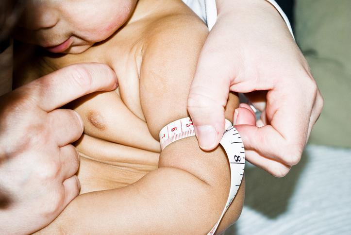  1 kilogramlık artış yüzde 9 risk anlamına geliyor