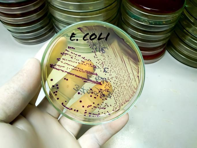  1 kilogramlık artış yüzde 9 risk anlamına geliyor