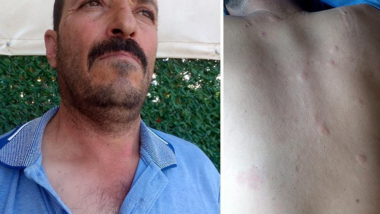Duyduğu seslere giden çiftçi hayatının şokunu yaşadı! Ayı saldırısından kurtuldum derken dehşeti yaşadı
