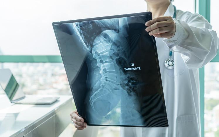 Çocukluk döneminde sık görülüyor Omurga eğriliği hakkında bilmeniz gerekenler