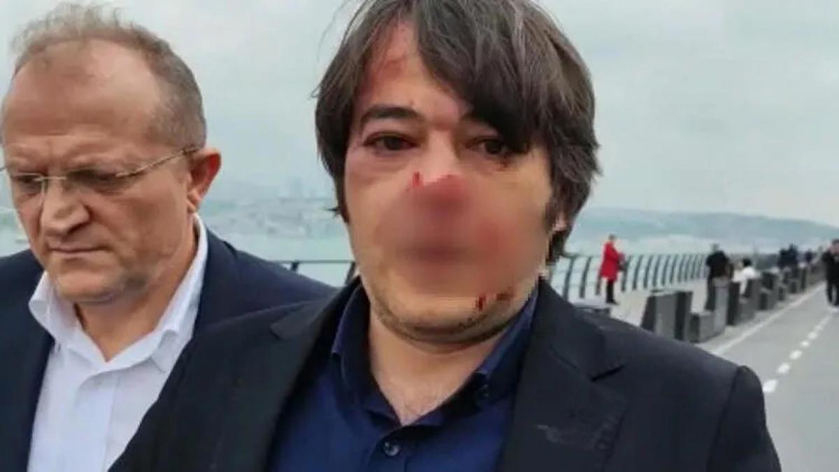 Üsküdar'da İBB'nin imar şube müdürüne saldıran 2 kişi gözaltına alındı