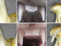 Japanese researchers test pioneering drug to regrow teeth