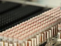 Turkish Red Crescent boosts hope for stem cell patients