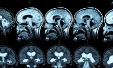 Acil doktoru kaderini değiştirdi... Yıllarca terapi gördü, ilaç kullandı ama gerçek çok başkaydı