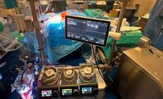 TÜSEB ve ASELSANdan işbirliği... Yerli ve milli kalp-akciğer makinesi tanıtıldı