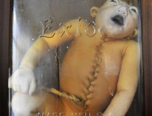 EU court bans patents of stem cells if embryo destroyed