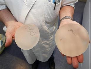 France may order 30,000 women to remove implants