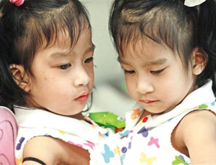 Twins of Philippines separated in the US