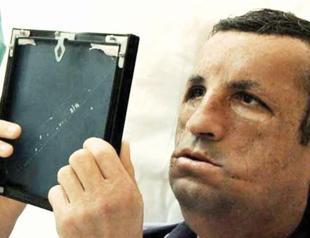 Crucial transplant surgery gives many patients hope