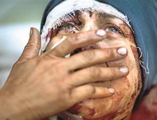 Pressure mounting for Syria cease-fire